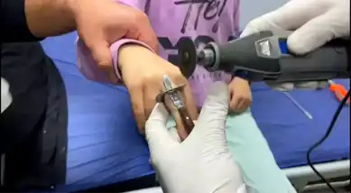 Batman'da Kız Çocuğunun Parmağı Sıkıştı!