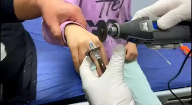 Batman'da Kız Çocuğunun Parmağı Sıkıştı!
